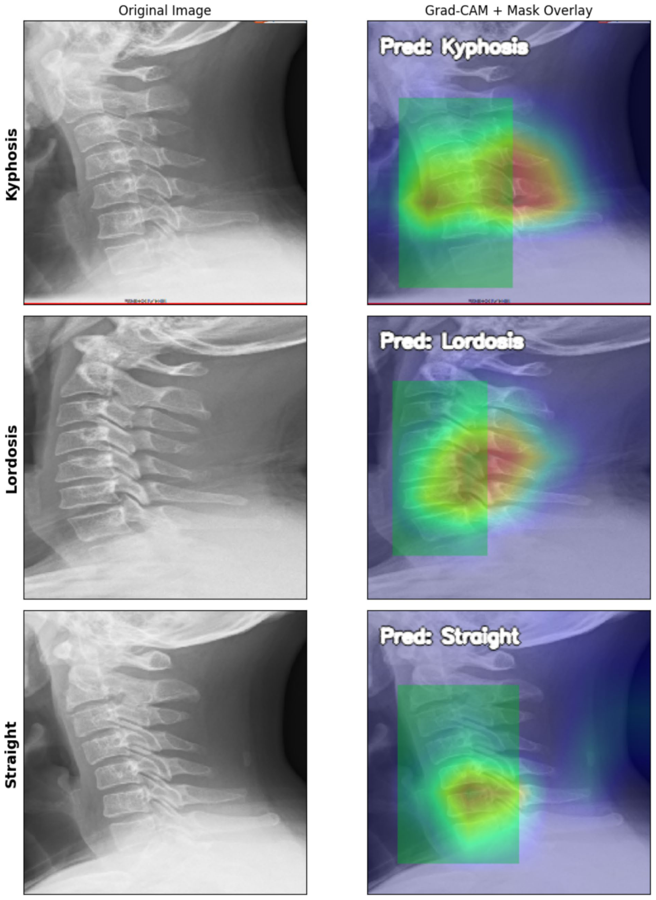 Figure 18