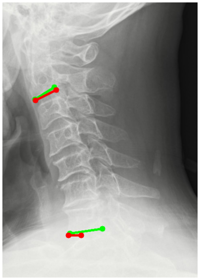 Figure 20