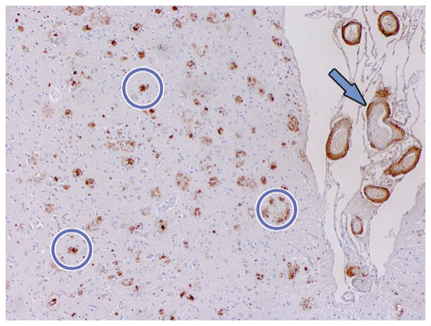Figure 11