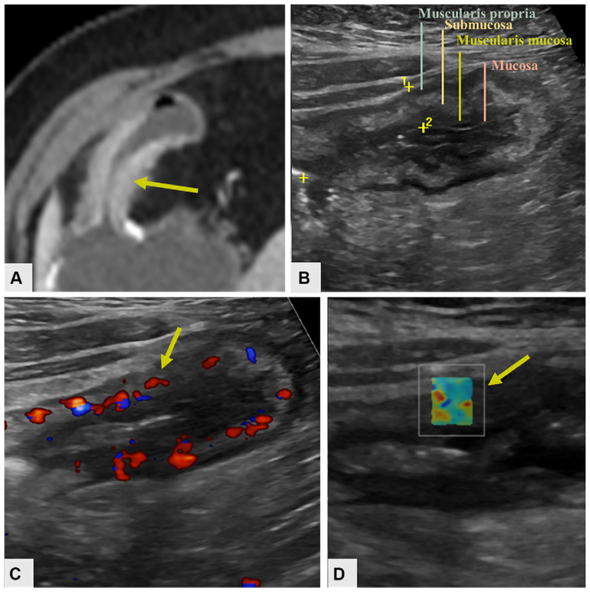 Figure 12