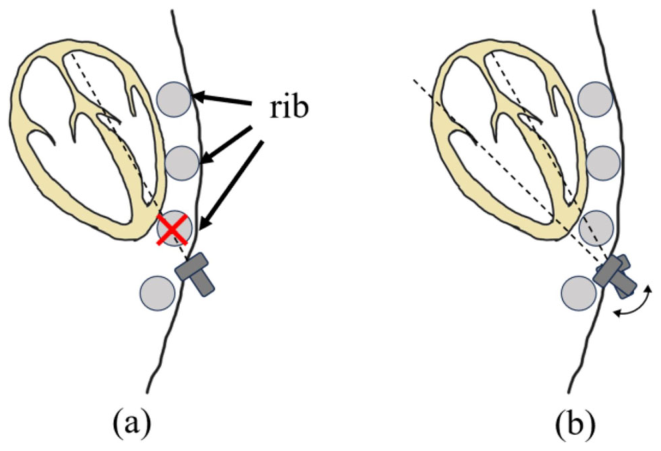 Figure 13
