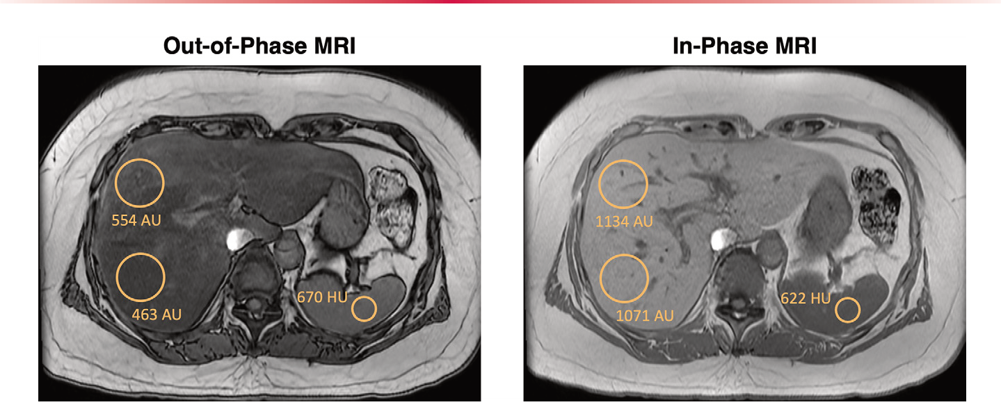 Figure 13