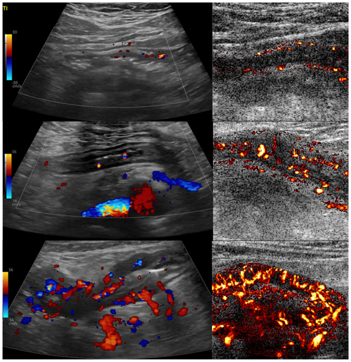 Figure 13