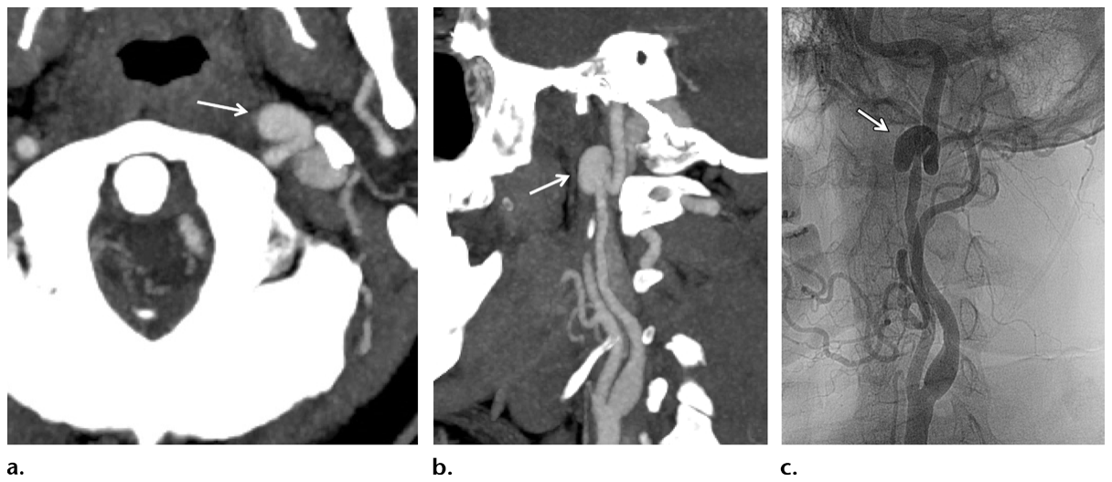 Figure 14