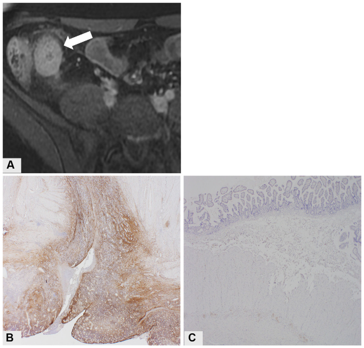 Figure 14