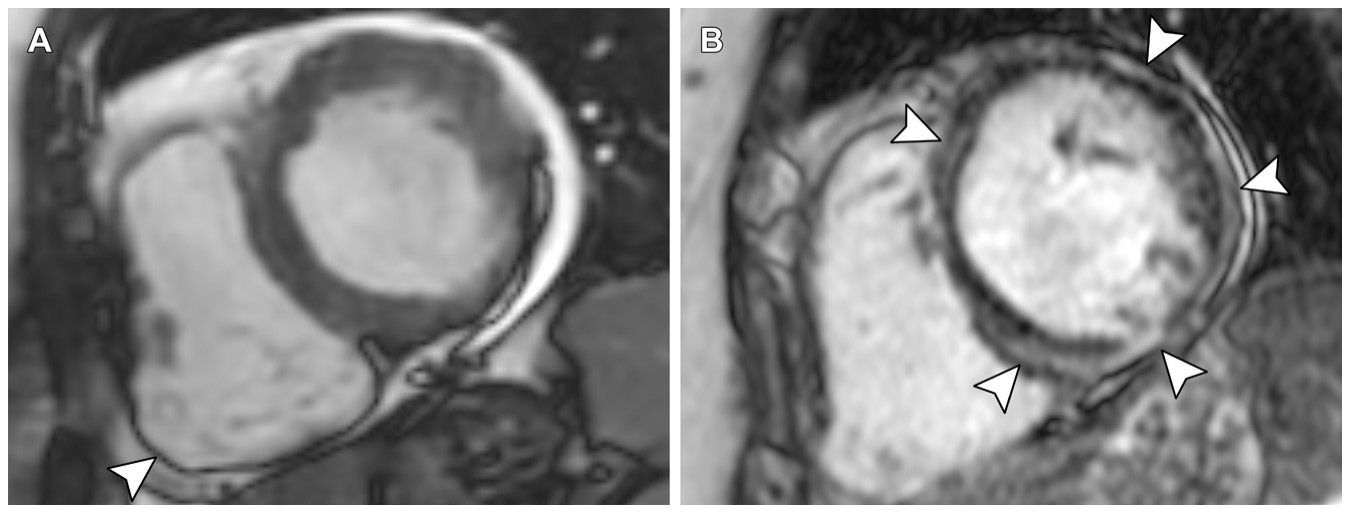 Figure 14