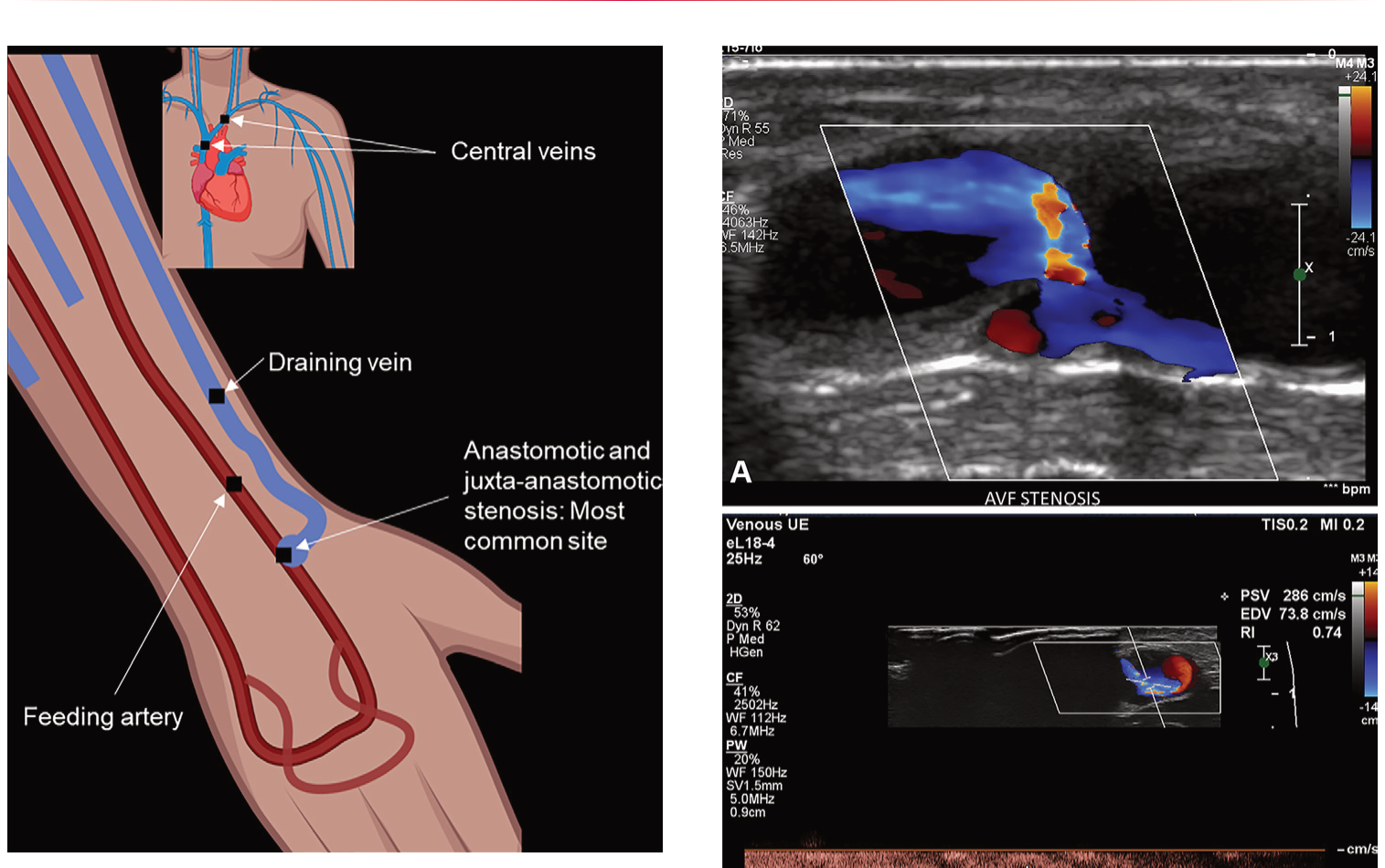 Figure 14
