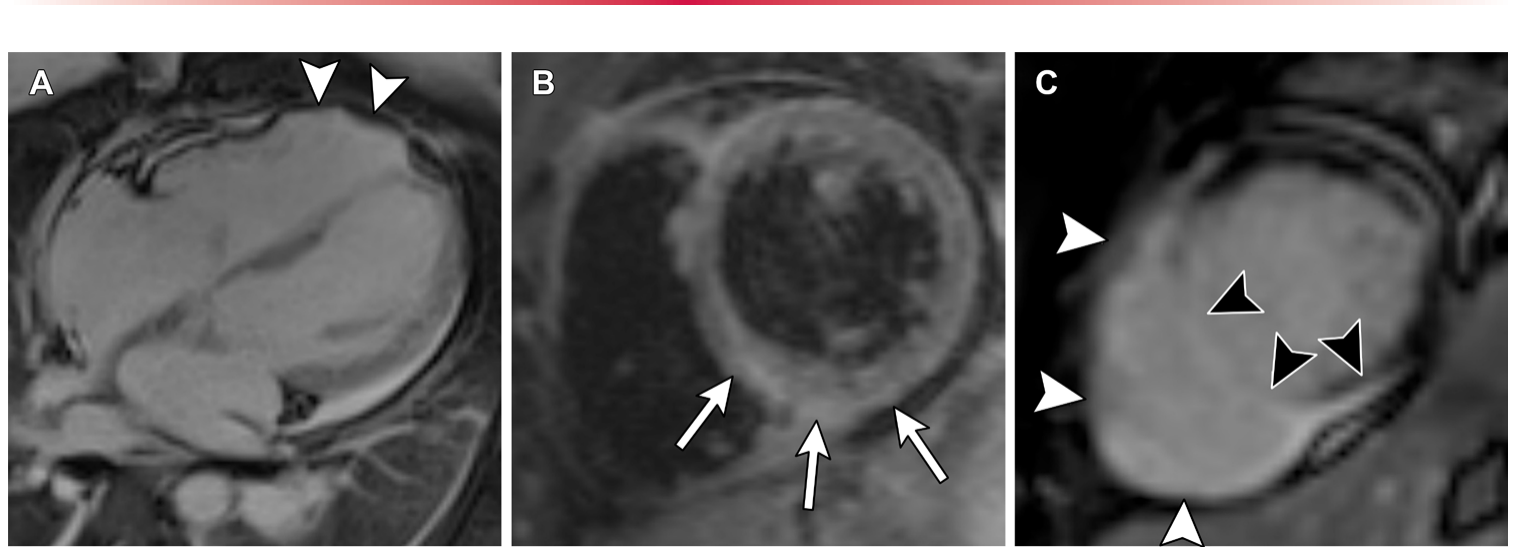 Figure 15