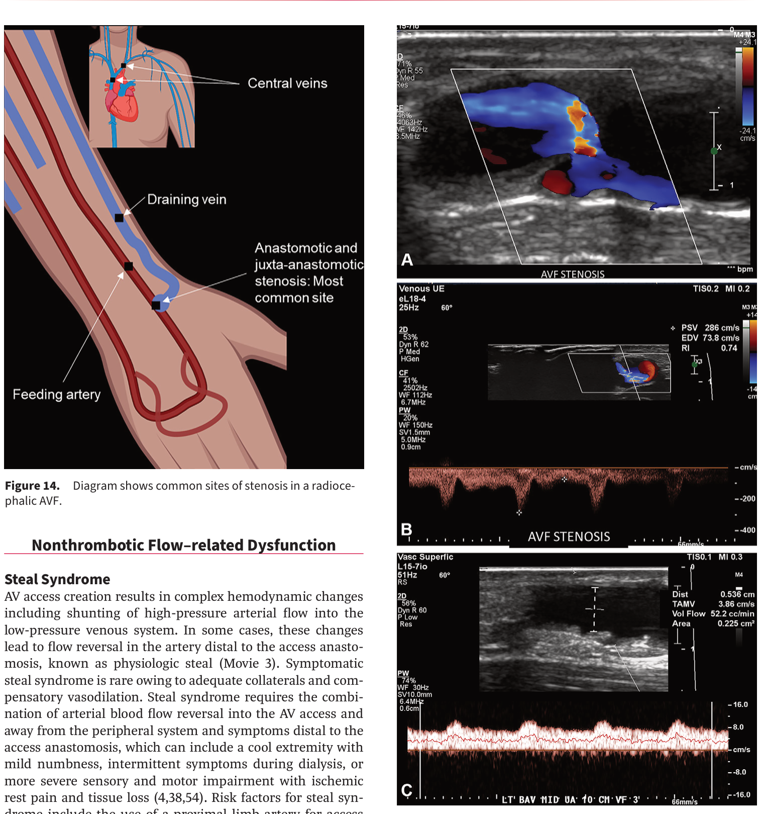 Figure 15