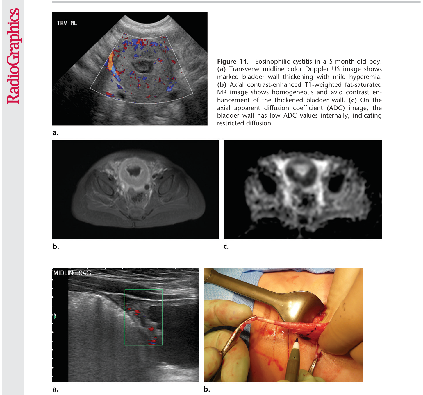 Figure 15