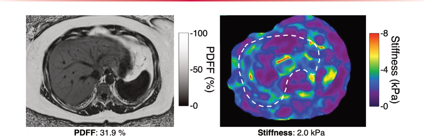Figure 16