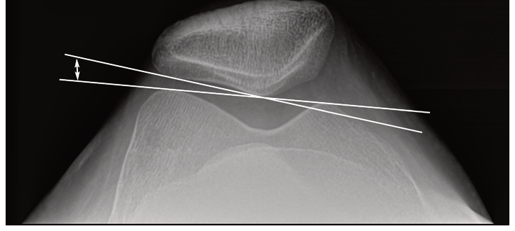 Figure 16