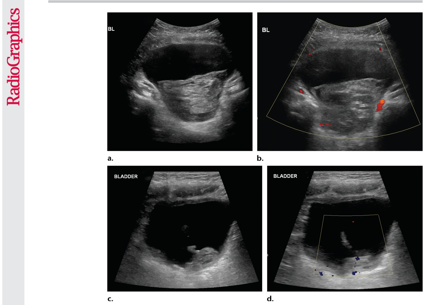 Figure 16