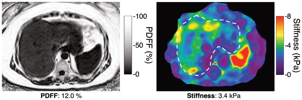 Figure 17