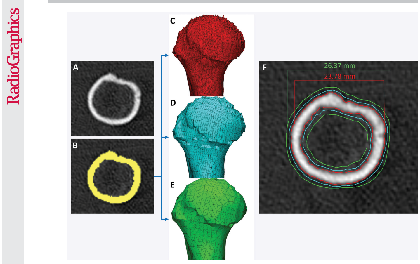 Figure 17