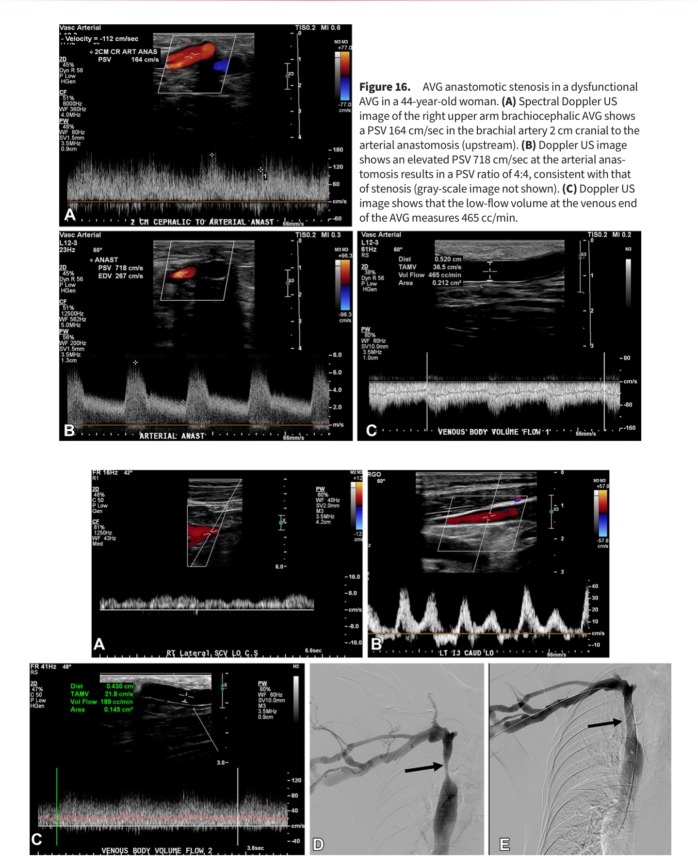 Figure 17