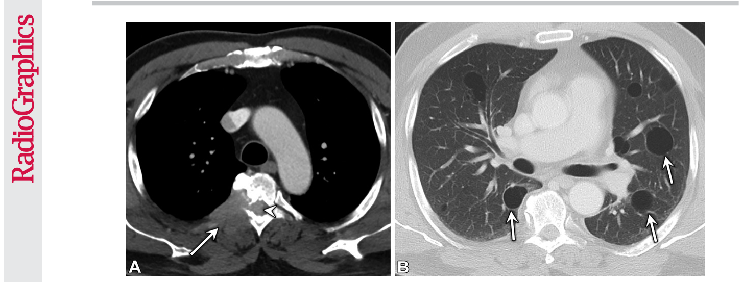 Figure 17