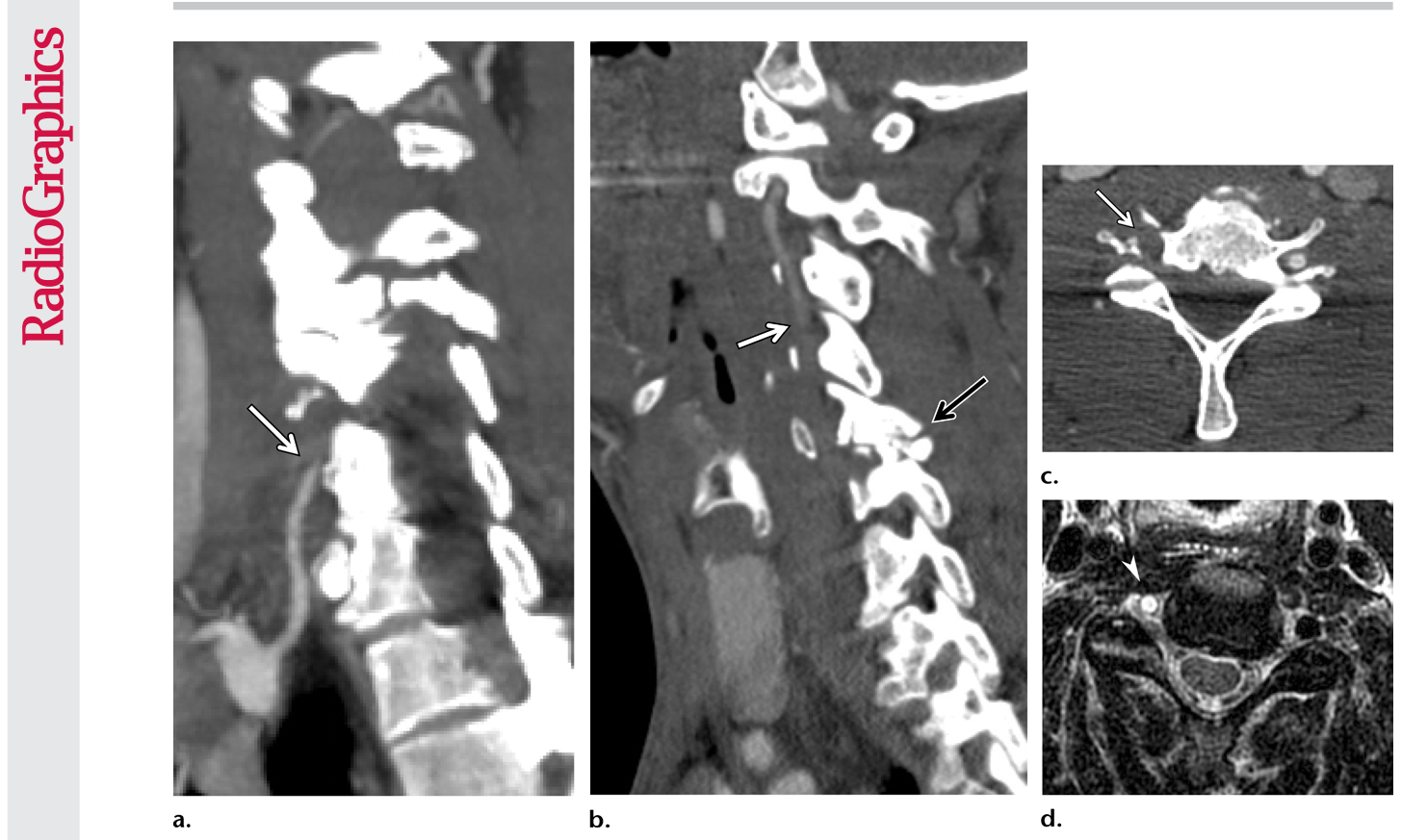 Figure 17