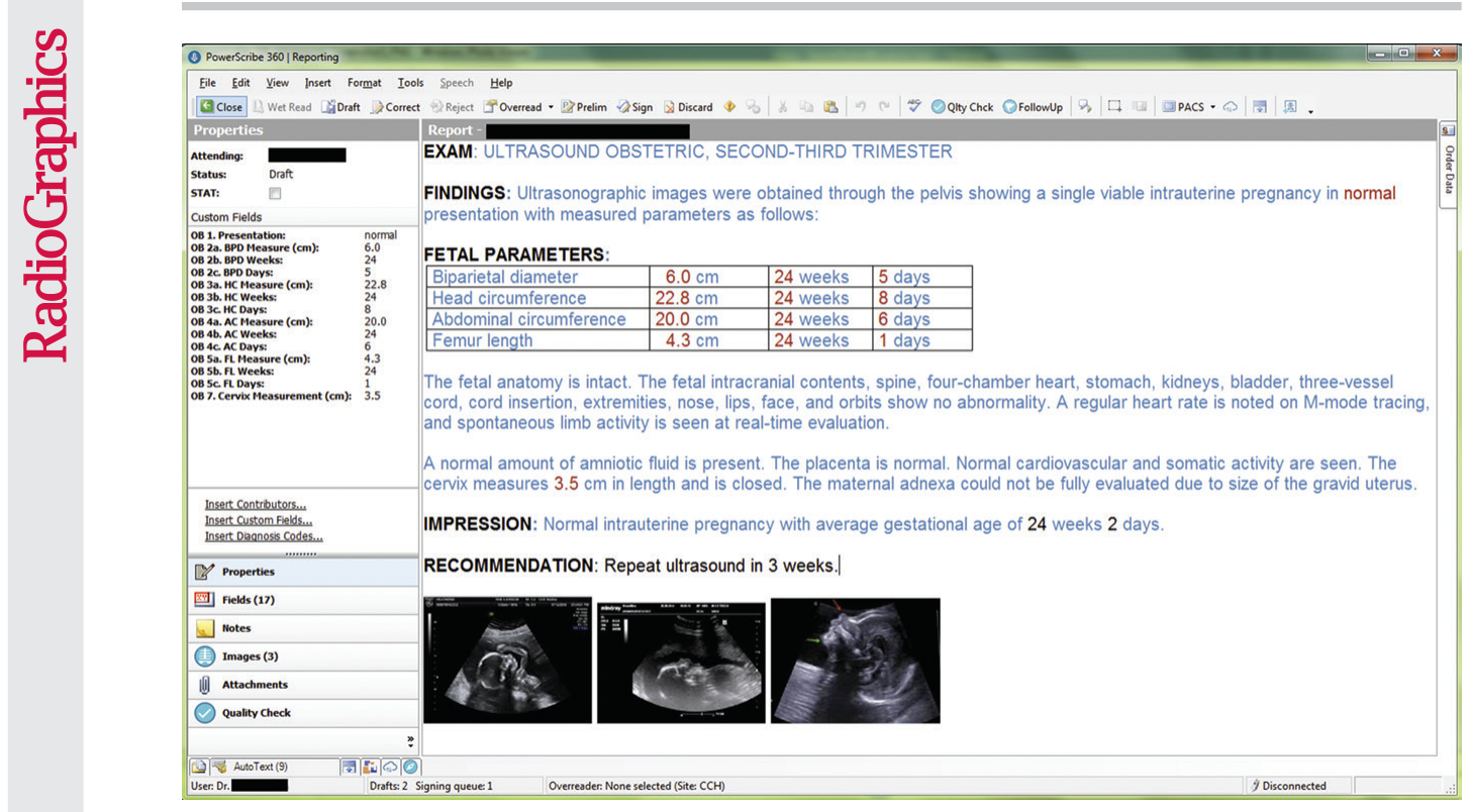Figure 17