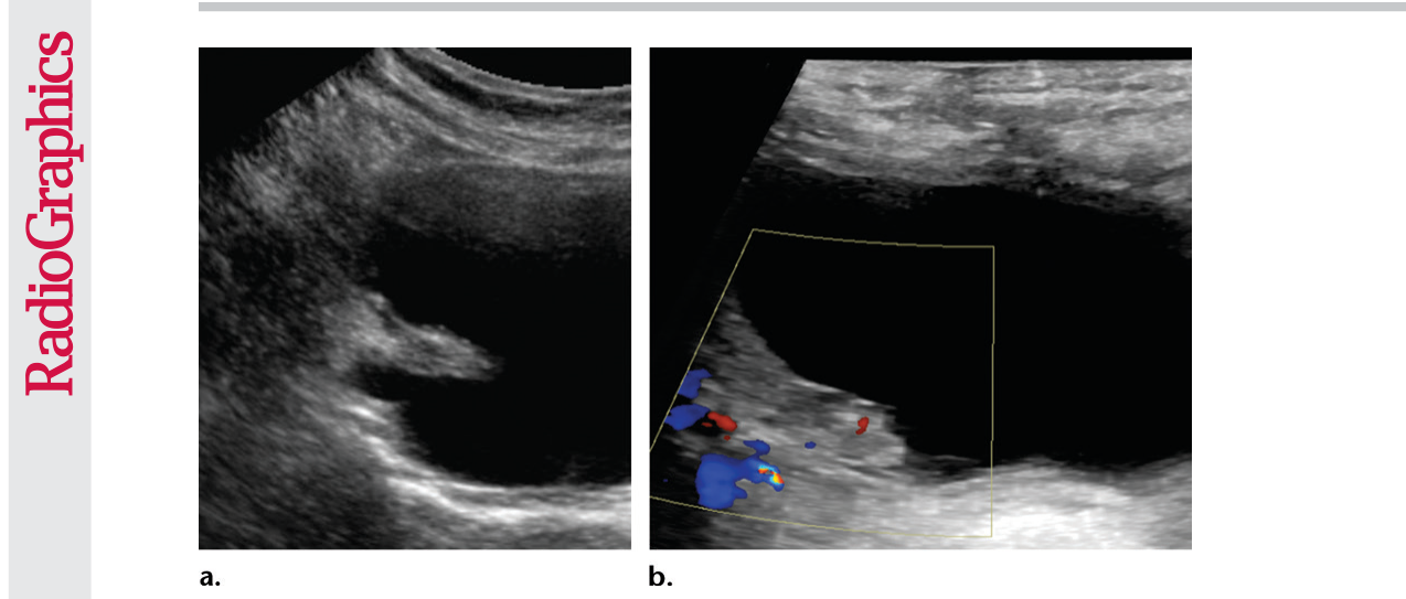 Figure 17
