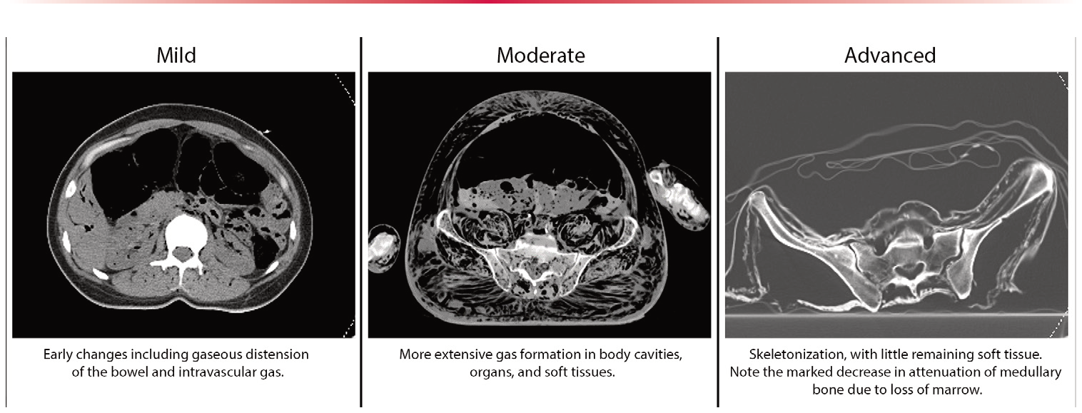 Figure 18