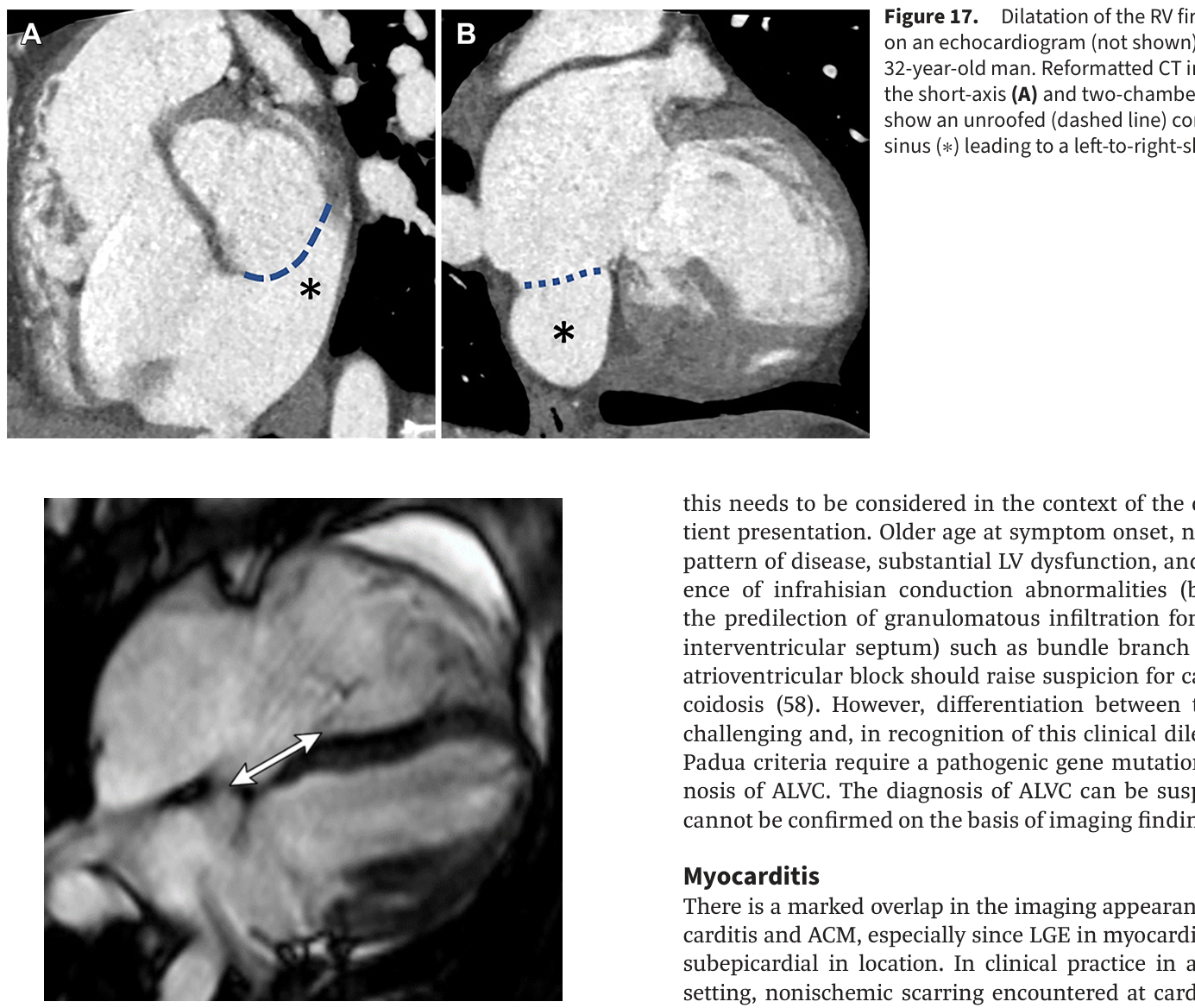 Figure 18