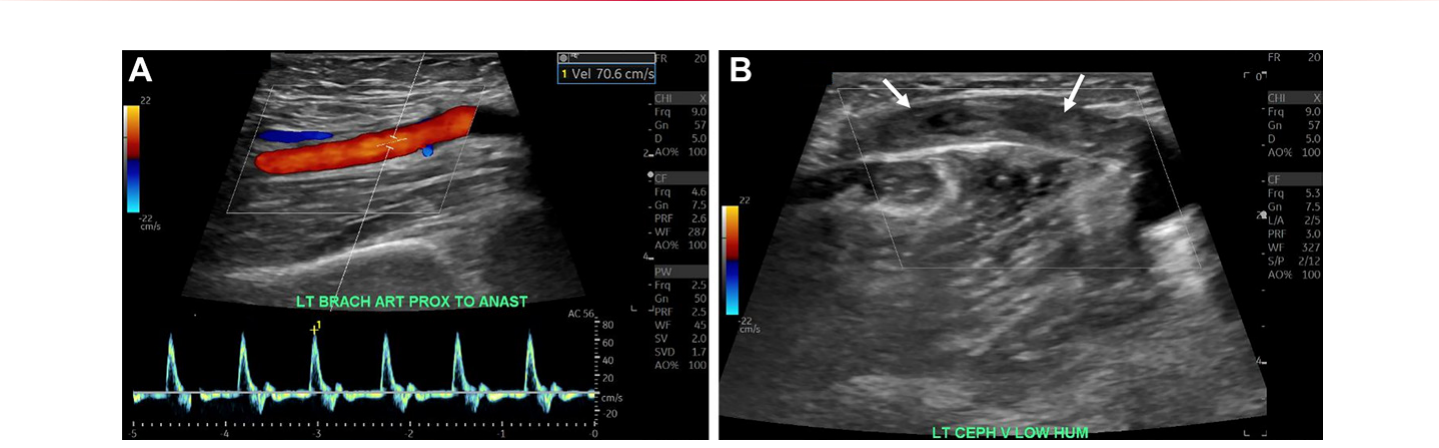 Figure 18