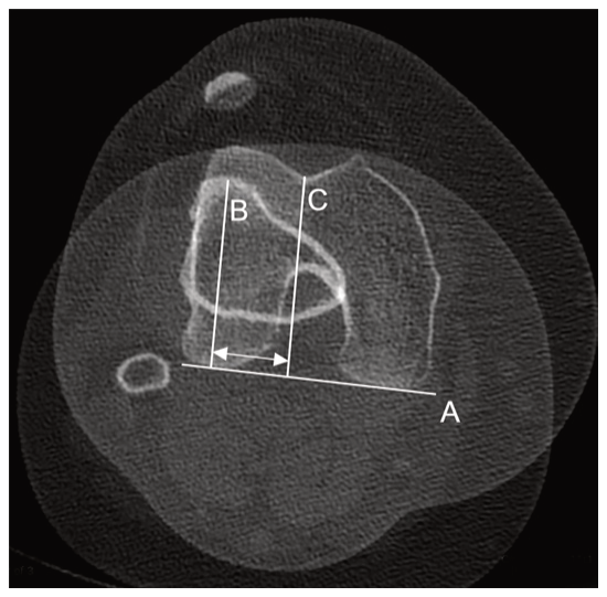 Figure 18