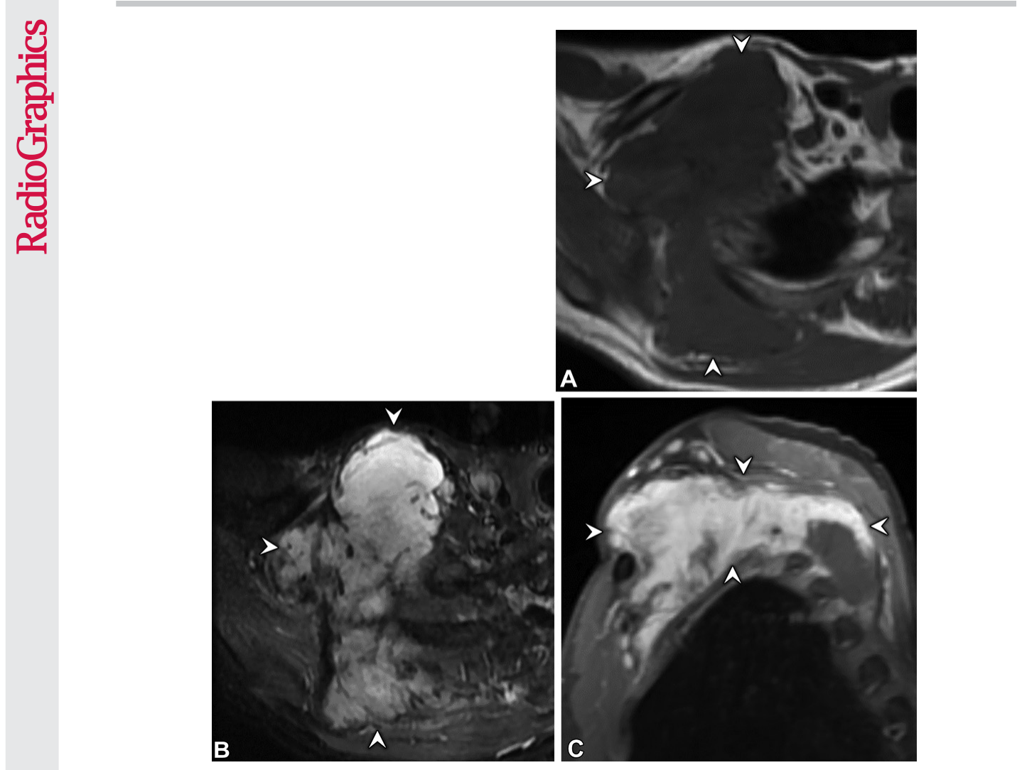 Figure 18