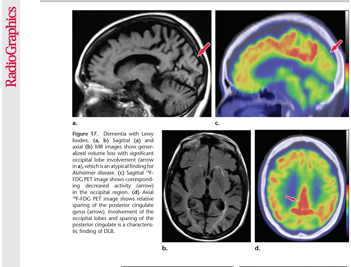 Figure 18