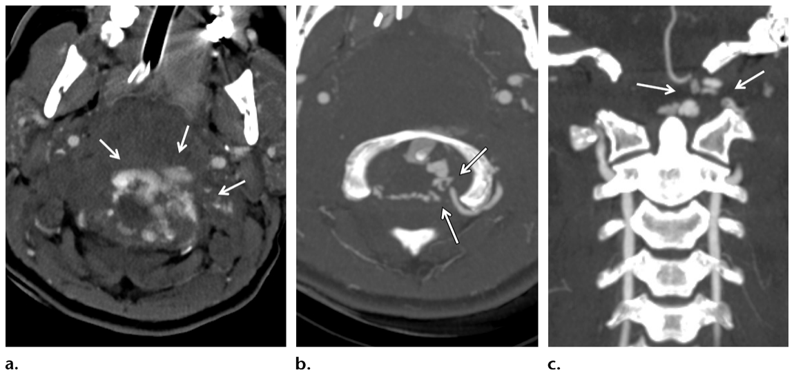 Figure 18