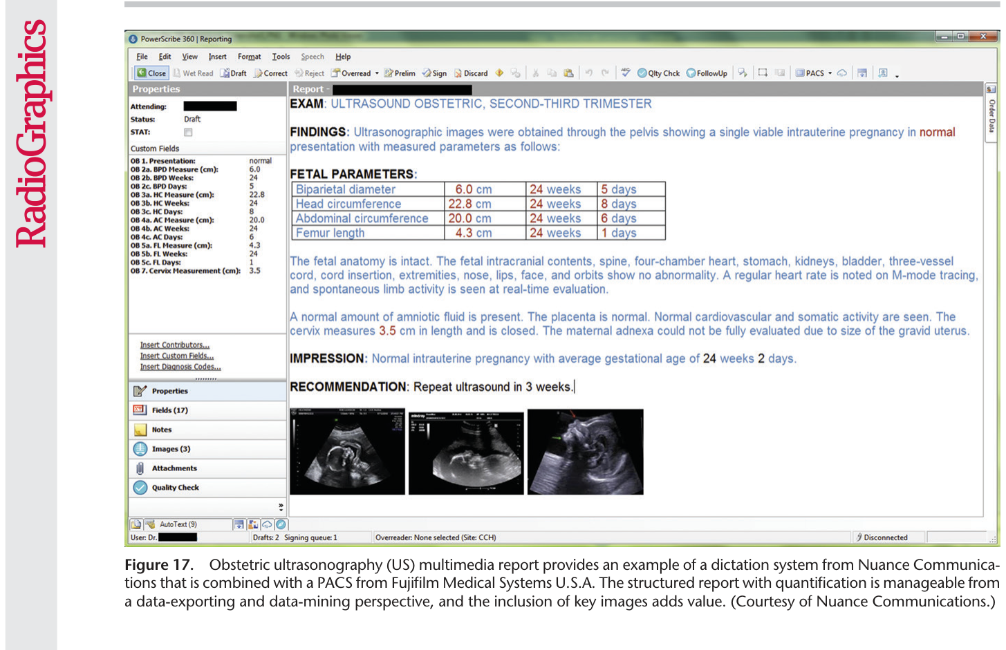 Figure 18