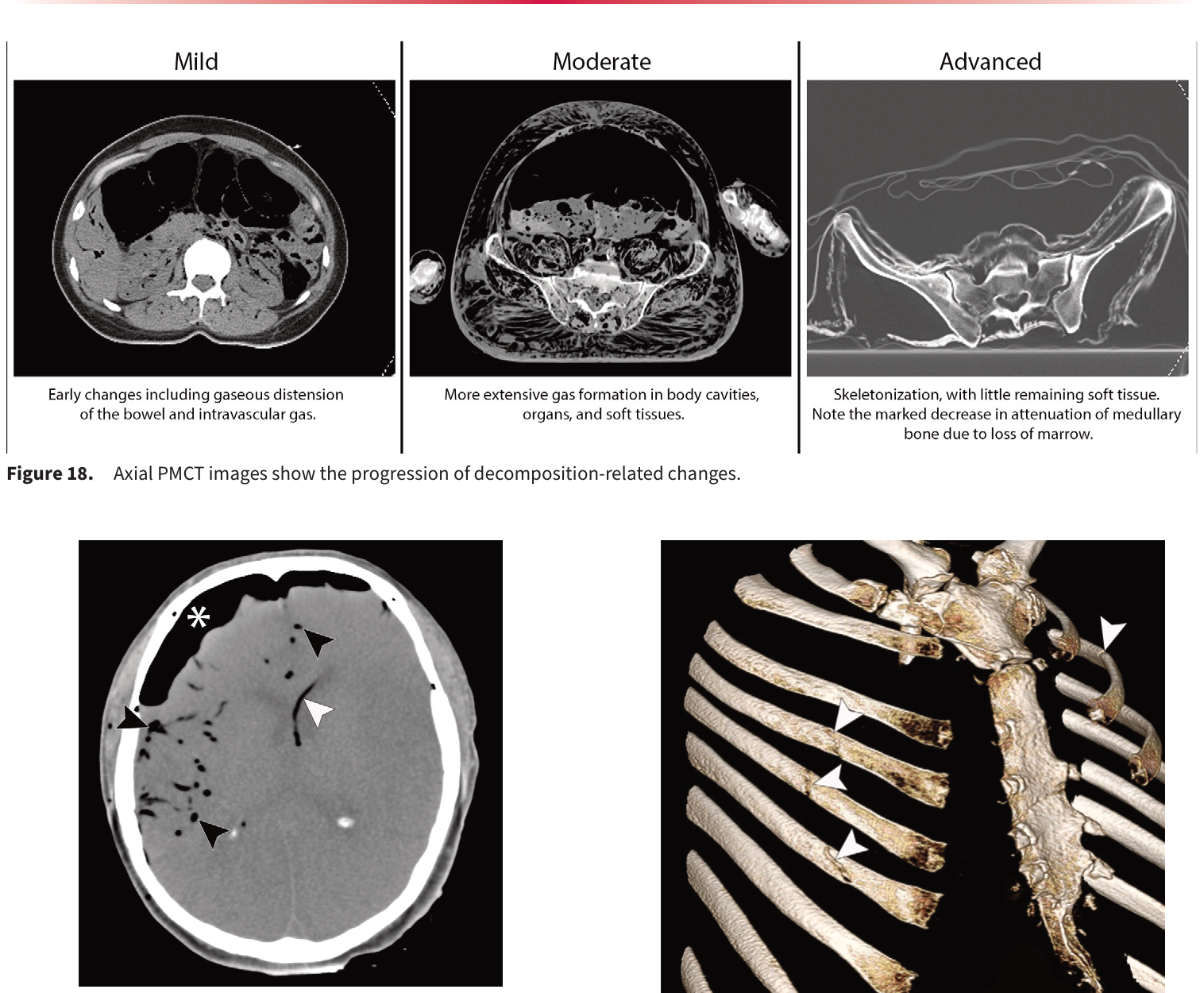 Figure 19