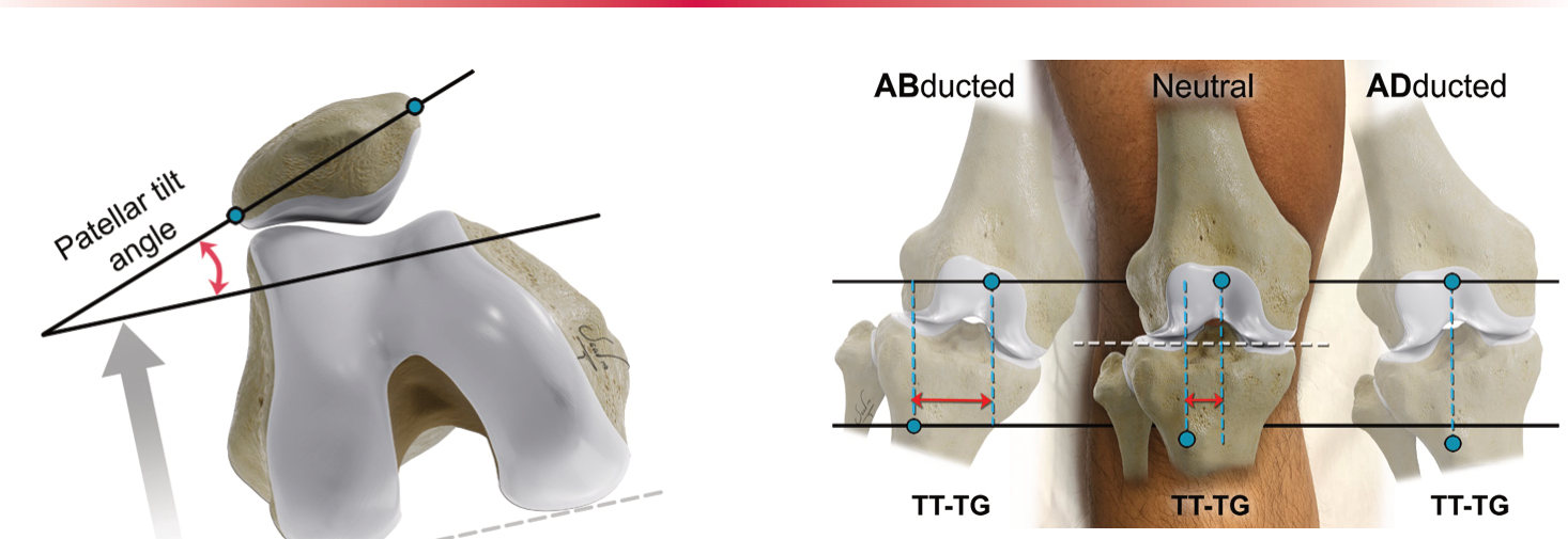 Figure 19