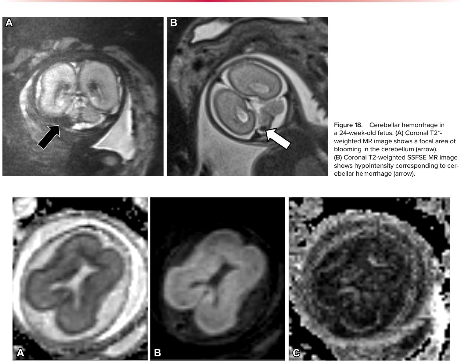 Figure 19