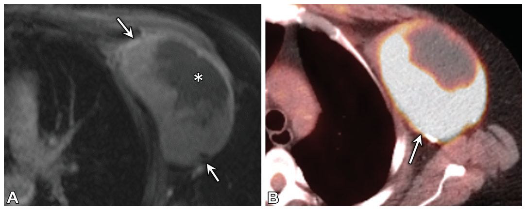 Figure 19