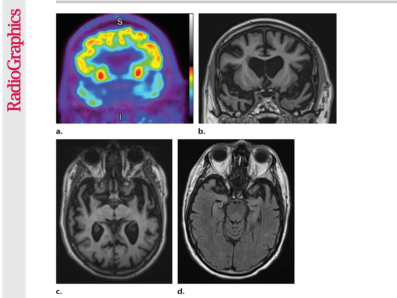 Figure 19