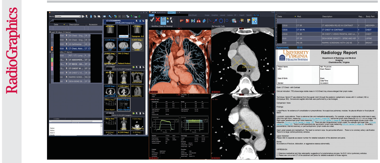 Figure 19