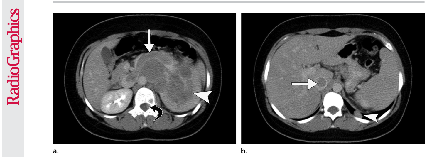 Figure 19