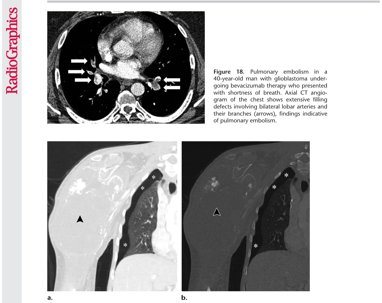 Figure 19