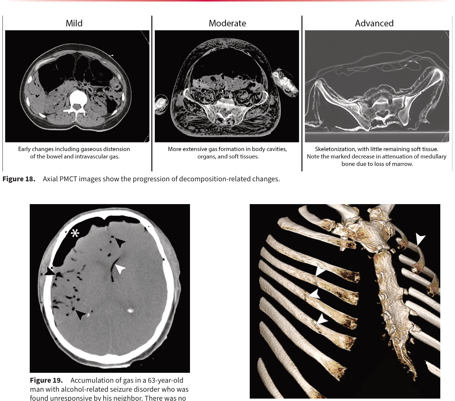 Figure 20