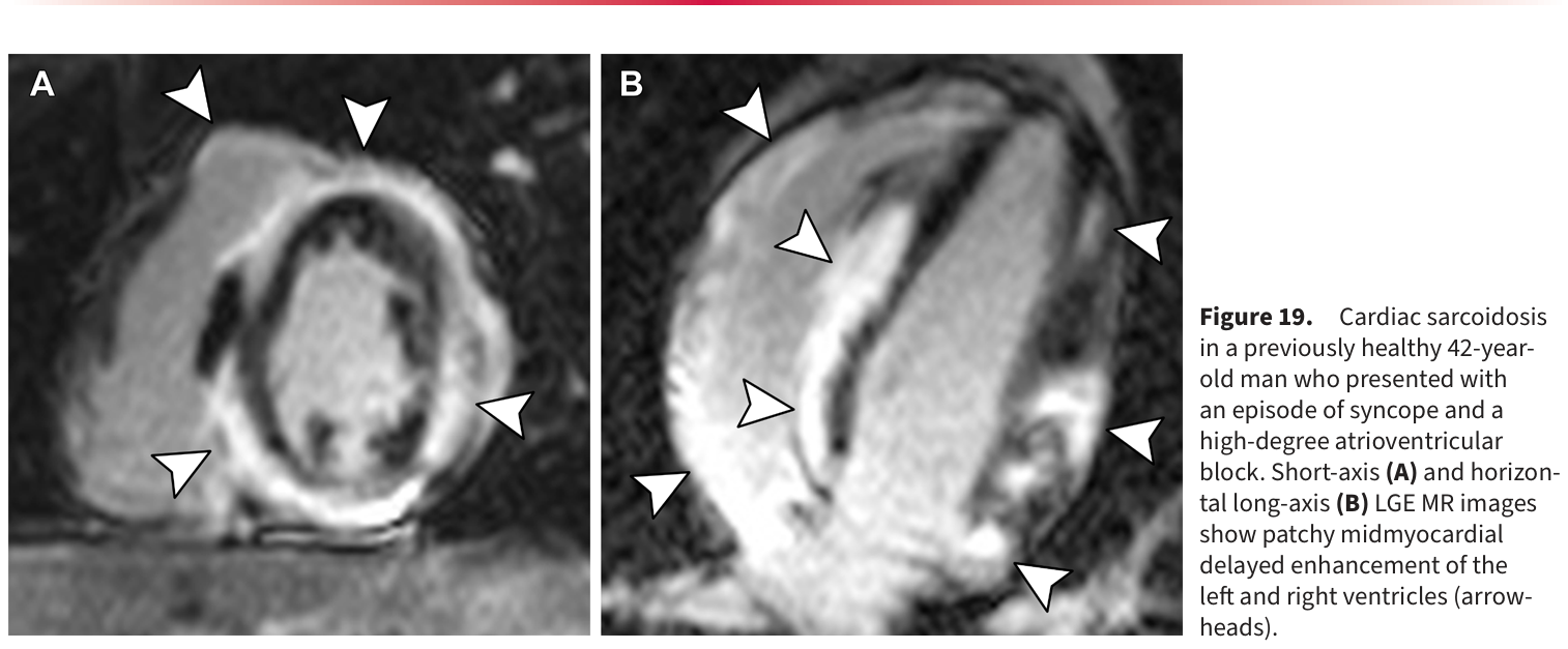 Figure 20