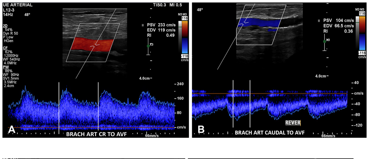 Figure 20