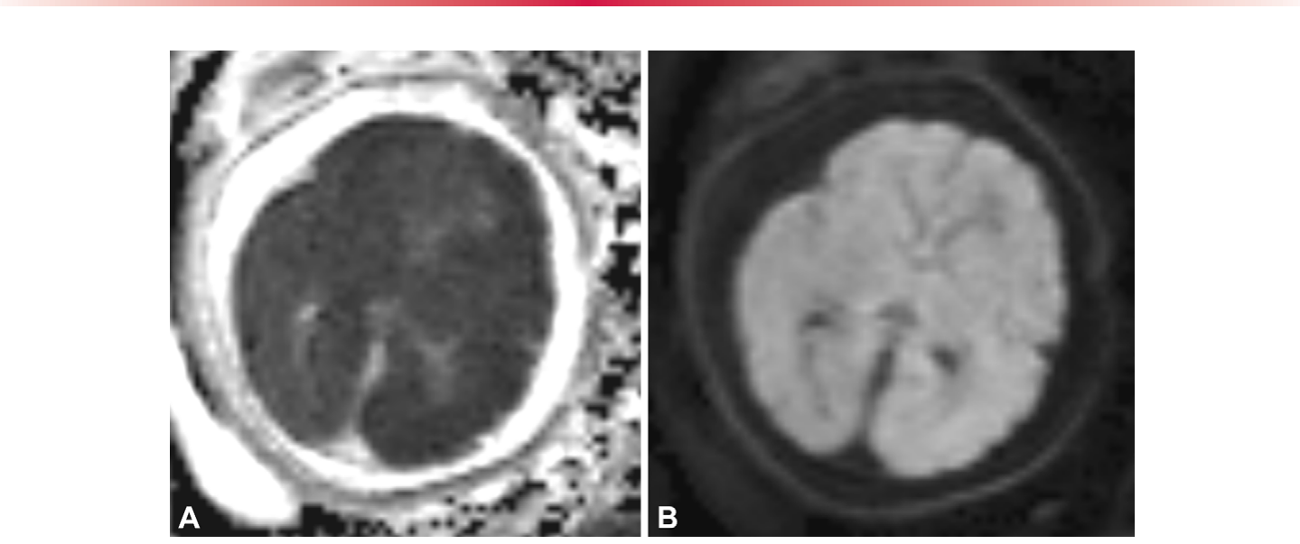 Figure 20