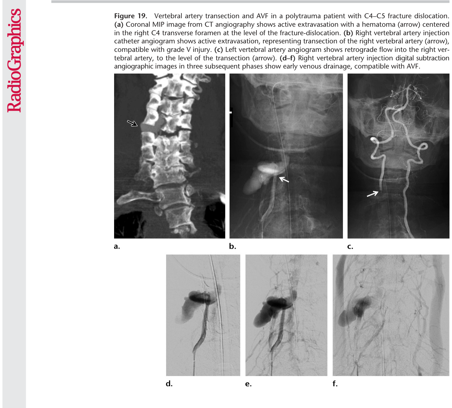 Figure 20