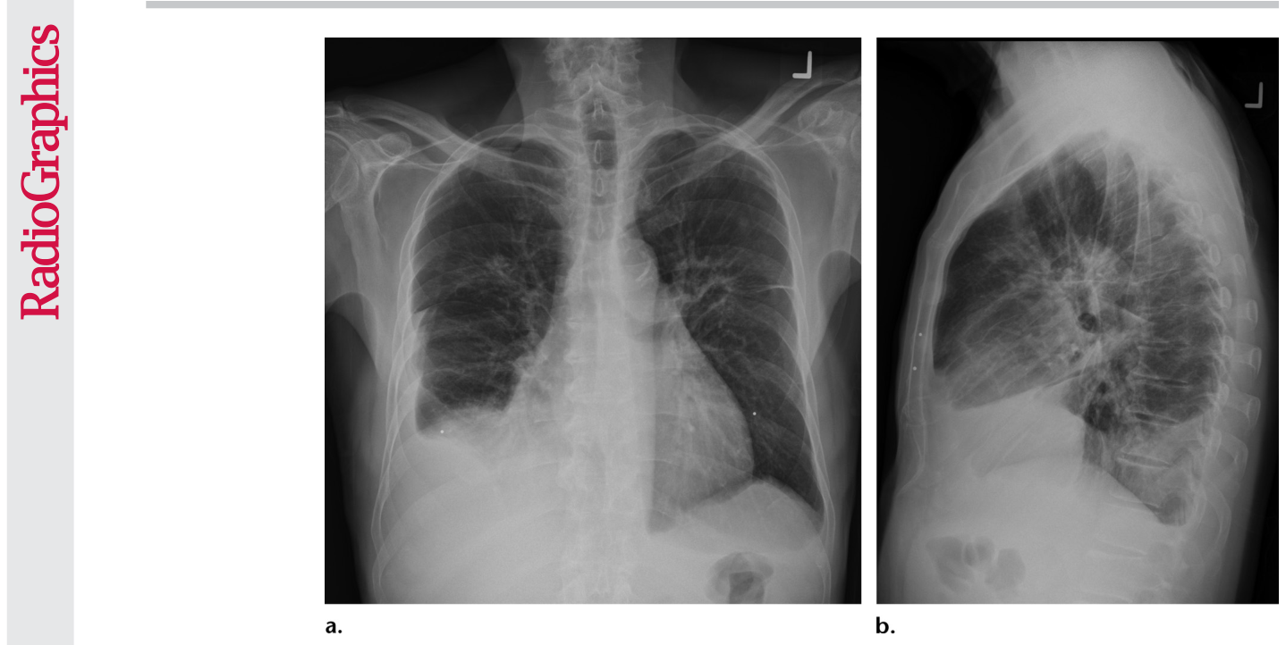 Figure 20