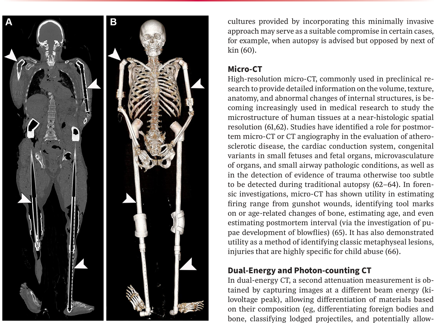 Figure 21