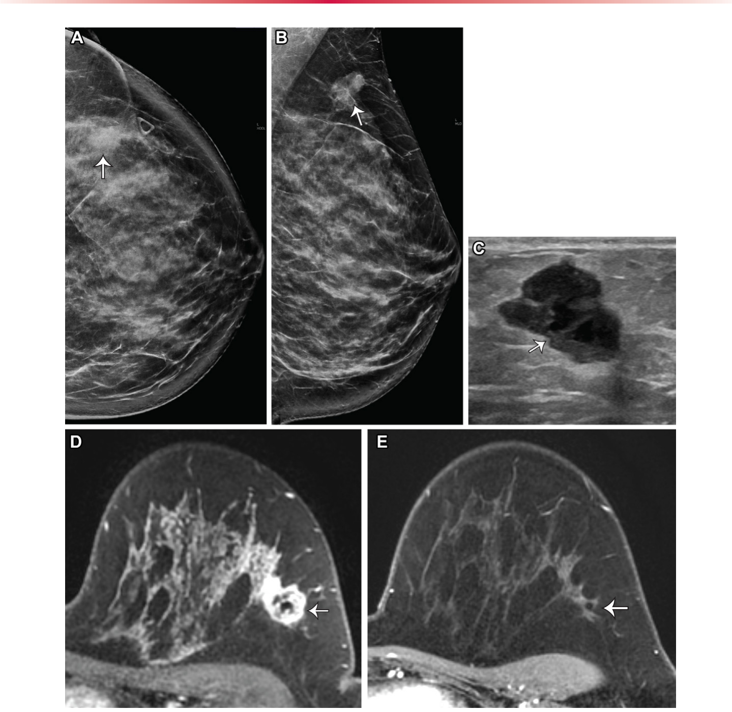 Figure 21