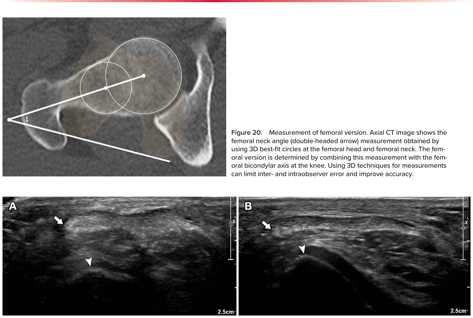 Figure 21