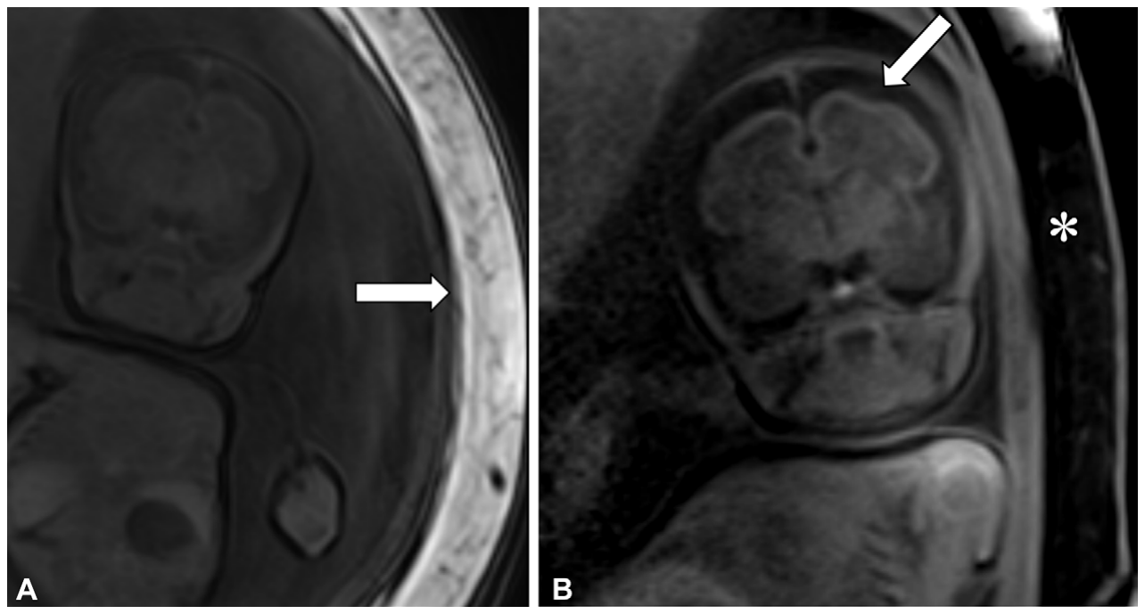 Figure 21